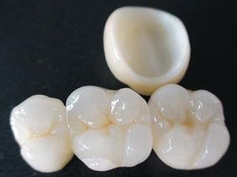 Con el uso del software de diseño CAD-CAM podemos mejorar el diseño y creación de restauraciones dentales, especialmente prótesis dentales incluyendo coronas, carillas, puentes, implantes y aparatos de ortodoncia