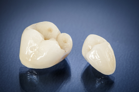 Coronas dentales de ceramica para un tratamiento de prótesis dental