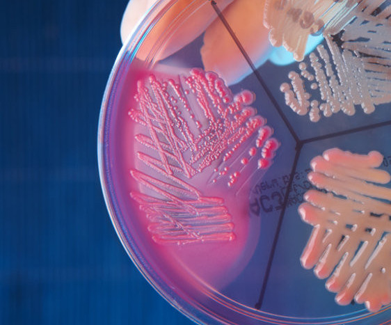Estudio microbiológico