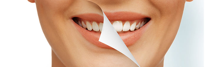 BLANQUEAMIENTO DENTAL